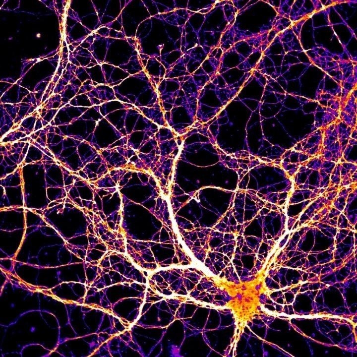 Científicos consiguen por primera vez controlar la actividad neuronal del  cerebro con luz - Republica.com