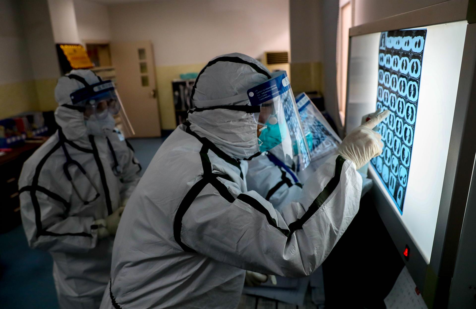 Científicos chinos detectan coronavirus en el semen de pacientes