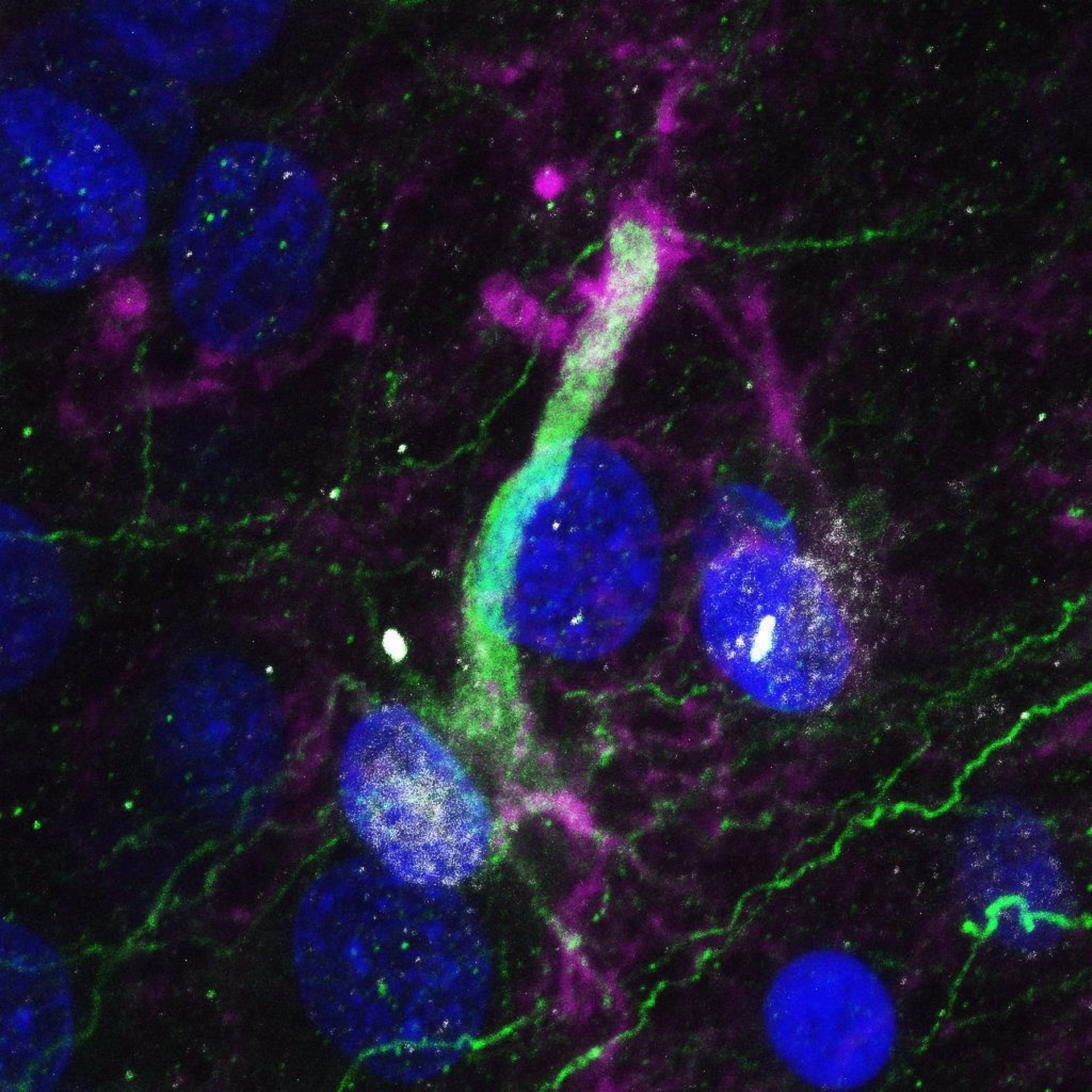 Un estudio revela la existencia de células madre en el cerebro que permiten generar neuronas a lo largo de toda la vida