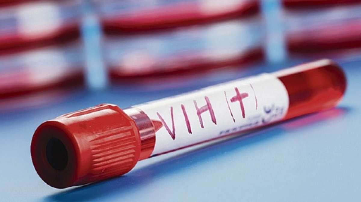 La OMS alerta de la subida de infecciones de VIH sin diagnosticar en la región europea