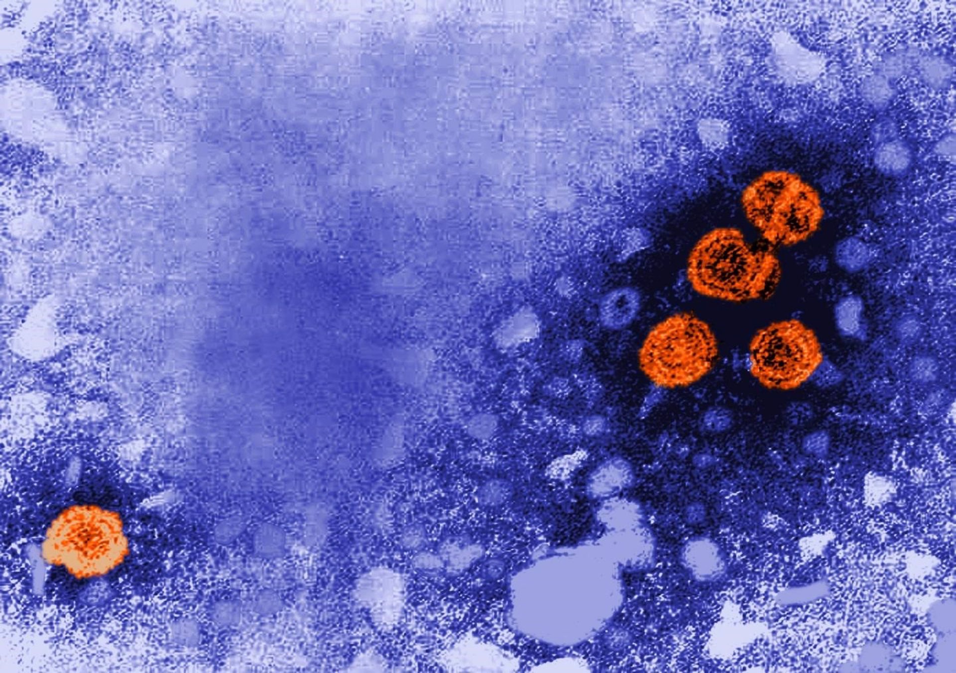 Primera muerte de un niño por hepatitis aguda de origen desconocido