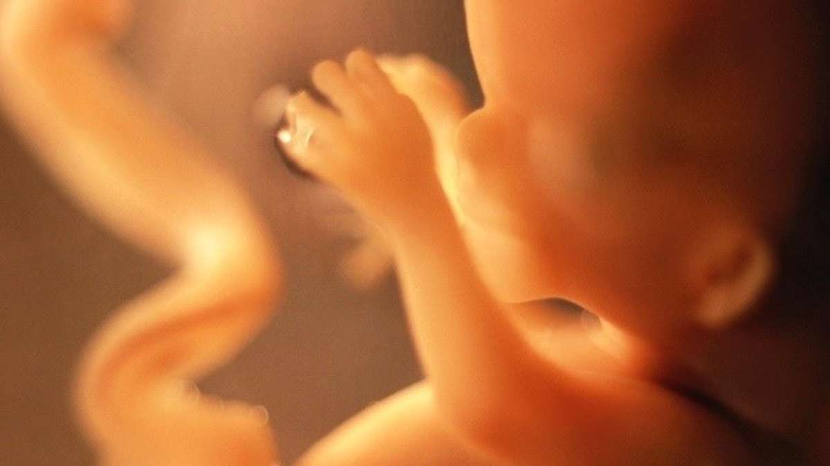 Foto de un feto durante un embarazo