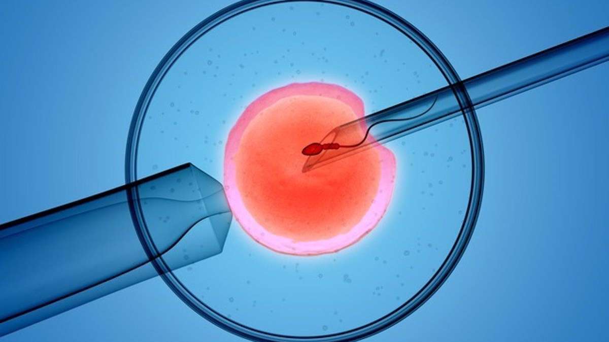 Fecundación in vitro, uno de los tratamientos contra la infertilidad.