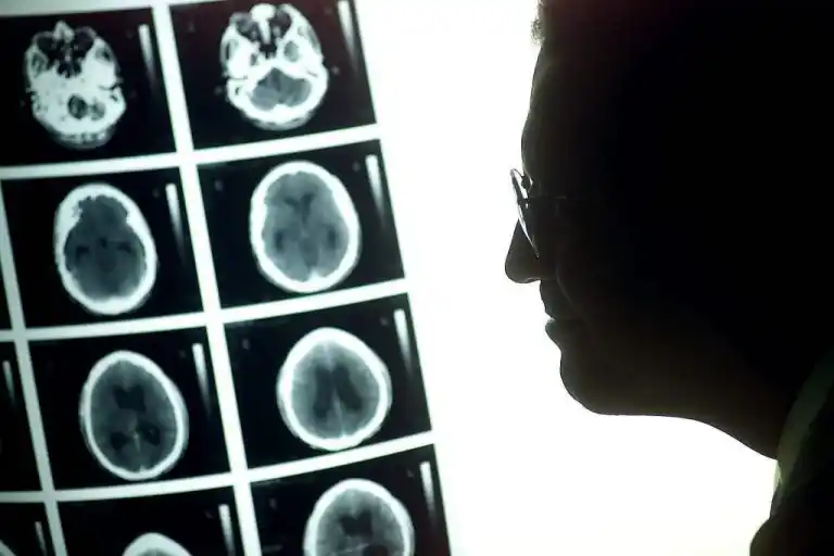 Logran detener varios años el avance de un tumor cerebral maligno con una pastilla