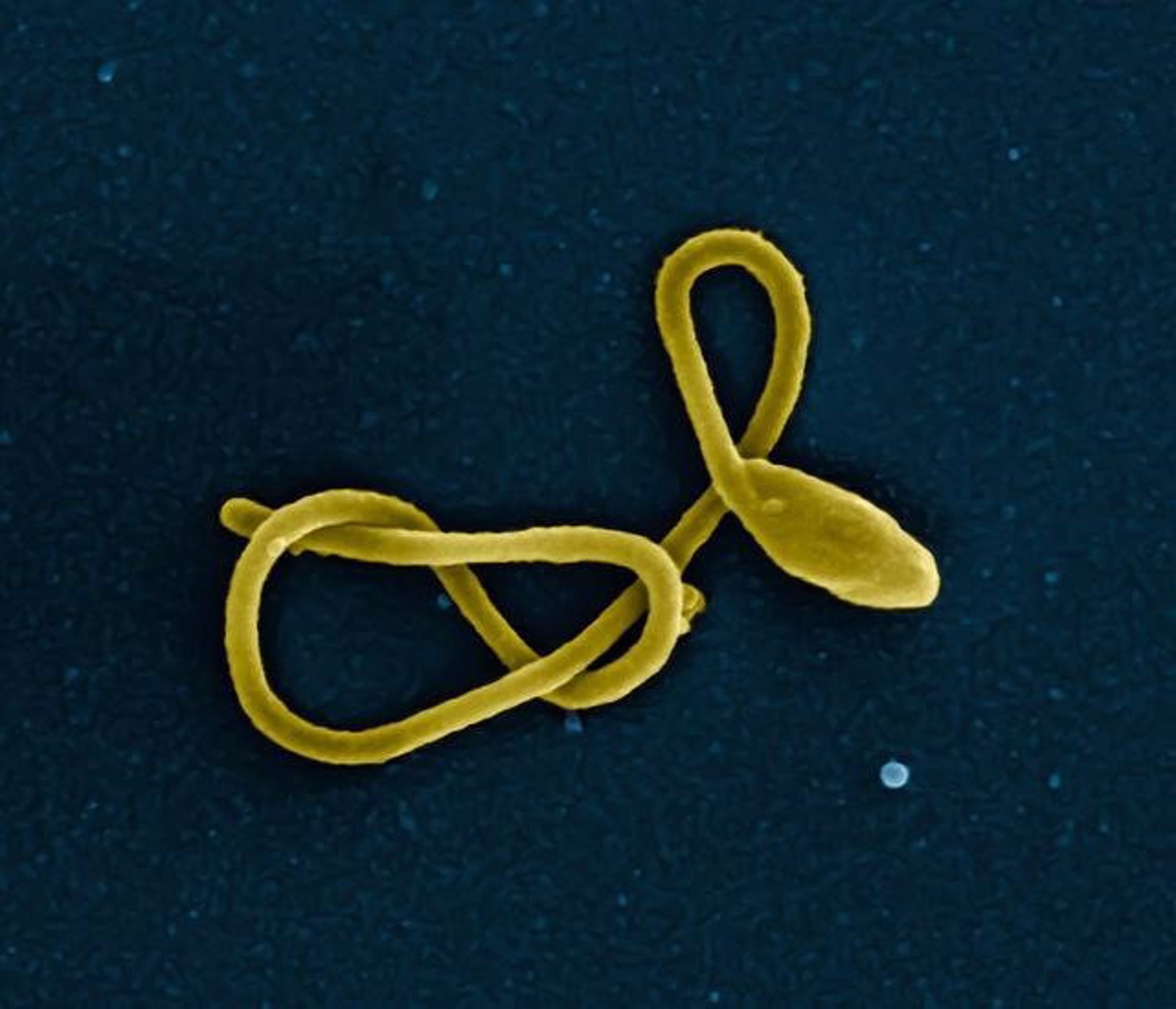 Partícula del virus del Ébola.