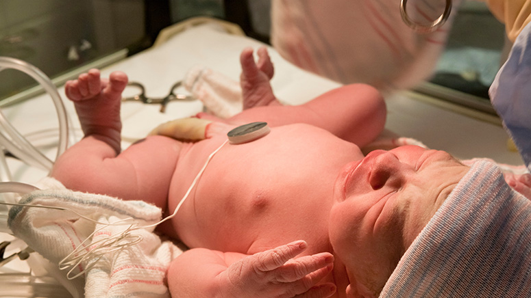 Cuáles son los cuidados para un bebé prematuro