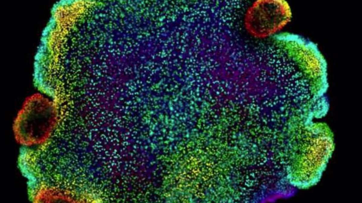 Imagen de microscopía confocal de núcleos, coloreados según la profundidad, de Trichoplax sp. H2, una de las cuatro especies de placozoos para las que los autores del estudio crearon un atlas celular.